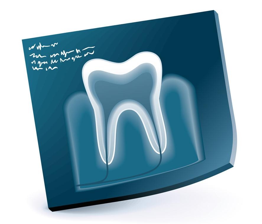 Bei uns, in Ihrer Zahnarzt Praxis Biewald in Güstrow, bekommen Sie eine Zahntherapie angeboten