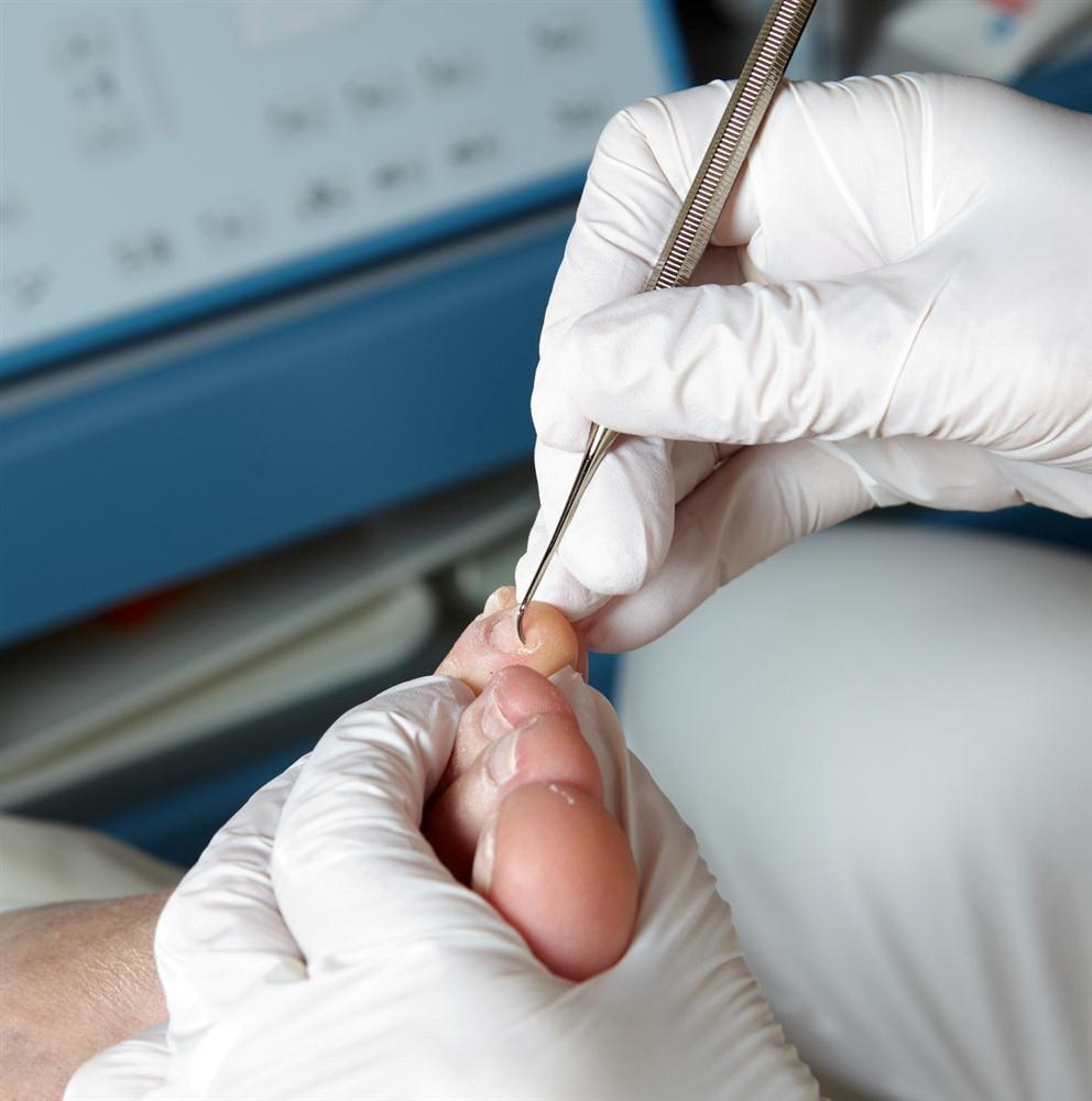 Treten Sie bei Bedarf nach podologischen Behandlungen oder medizinisch – diabetische Fußbehandlungen an die Praxis für Podologie Noa in Bad Frankenhausen heran!